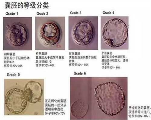 广州代孕怎么取卵：广州金宝宝代孕：找代孕女