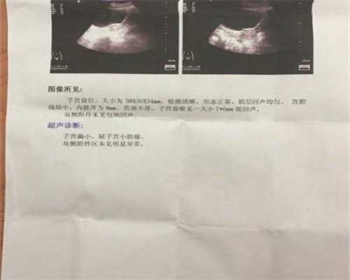 广州试管供卵：子宫内膜异位症引起不孕是怎样