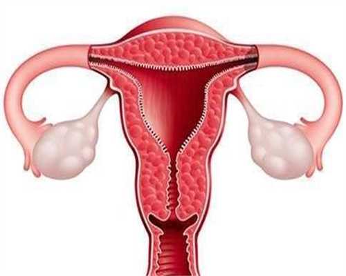 广州供卵试管助孕机构：子宫肌瘤哪些情况会导