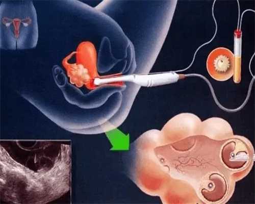 广州人工代孕合法吗：孕妇能吃黄豆吗-怀孕吃大