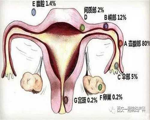 广州专业代孕多少钱,借卵生男孩,牙龈肿痛吃饭都