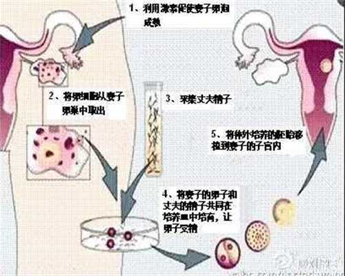 广州最新代孕法规_广州正常人可以代孕么【用科技关爱，助你拥抱可爱下一代